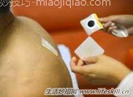 皮肤上粘着的膏药怎样去除？ 