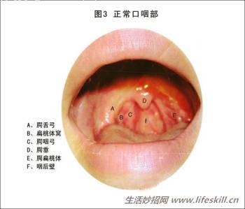 慢性咽炎的简易食疗方法