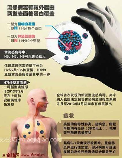 H7N9禽流感的发病症状 