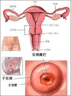 正确认识宫颈