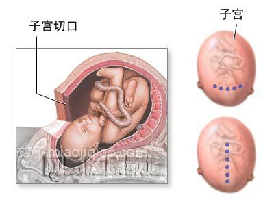 急产病人的急救处理