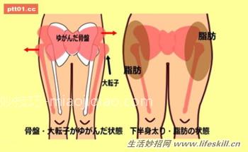 姿势不良导致骨盆凸出变成大屁股？快来试试这３招！