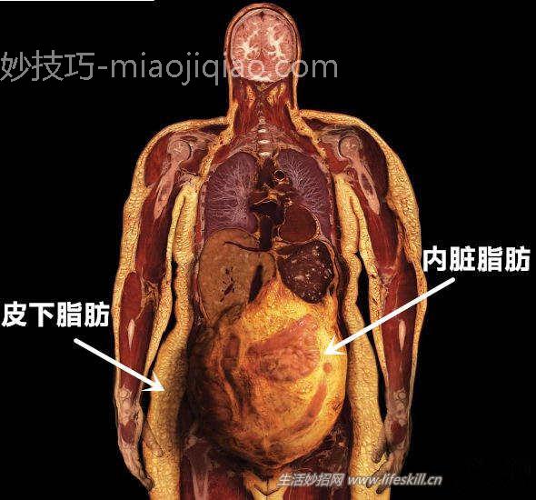 怎么让“水桶腰”恢复成“小蛮腰”？